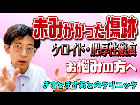 【ケロイド・肥厚性瘢痕を諦めていませんか？】形成外科の院長がケロイド、肥厚性瘢痕について詳しく解説します。