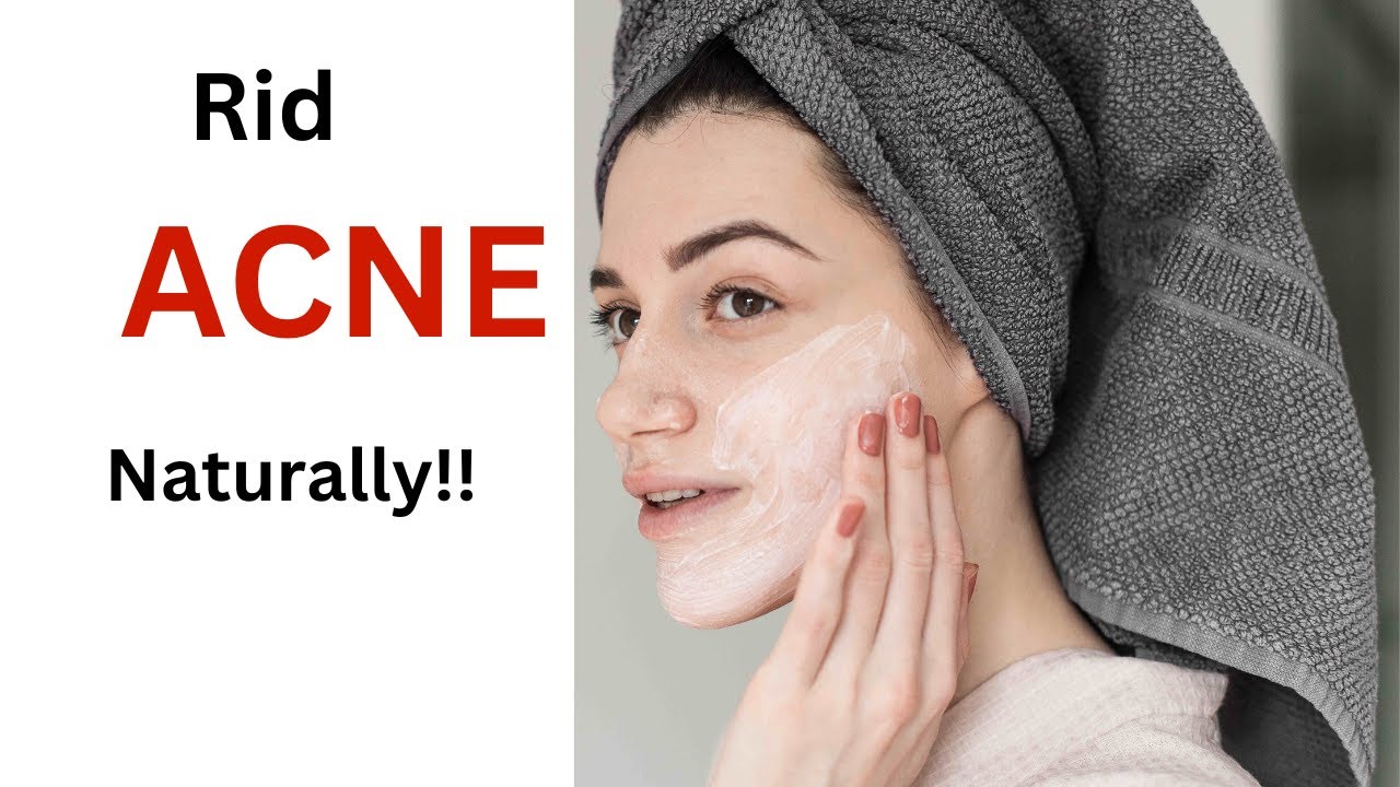 Curated visual reference: Fresh Look at 5 Effective Acne Solutions You Can Make At Home