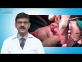 Cims hospital  dr darshan bhansali  mouth cancer causes and treatment