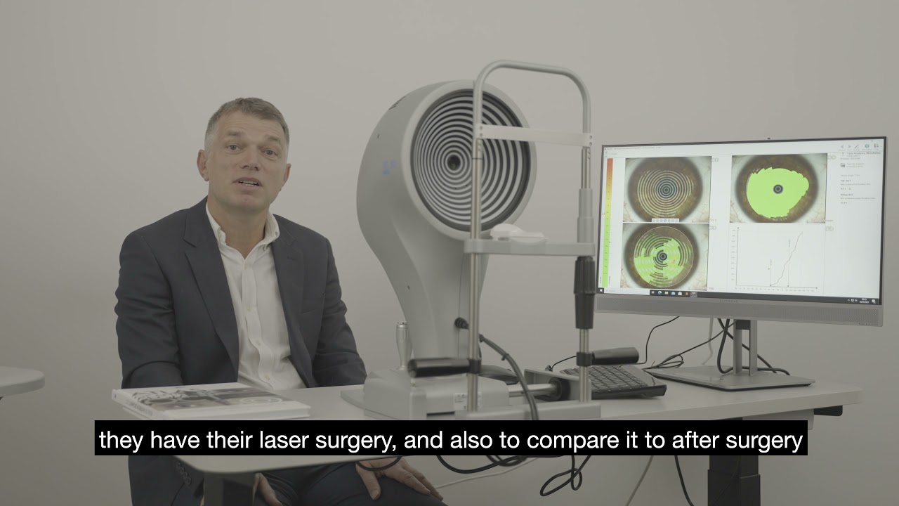 MS-39 AS OCT | Measuring the tear film quality is a must for surgery.