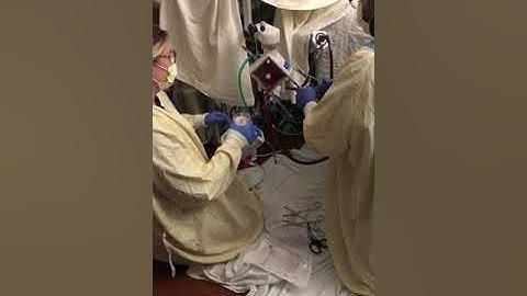 Oxygenator Change Win