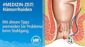 Können Hämorrhoiden beim Stuhlgang abgehen?