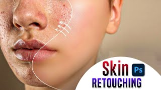 @SanguBoragiSanguCreation Flawless Skin Retouching in Photoshop (Easy Tutorial