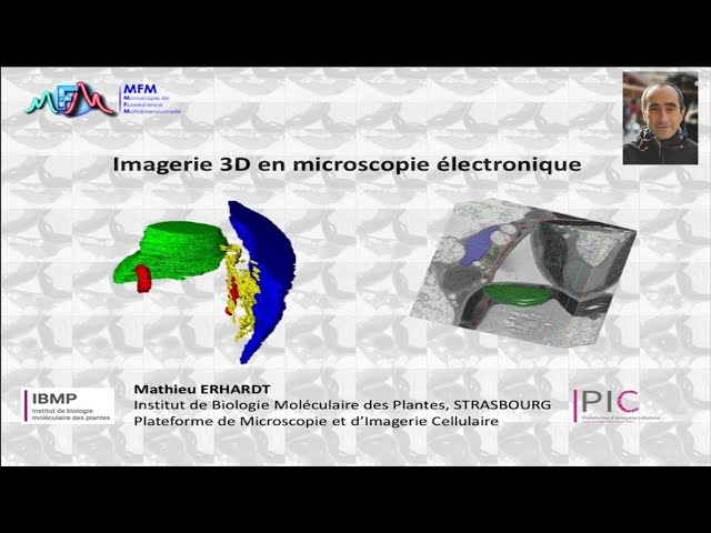 Diaporama : des images de microscopie électronique à couper le souffle