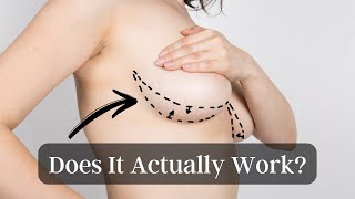 THE TRUTH About Internal Bras in Breast Implants