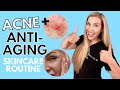 Acne + Anti-aging Skincare Routine | LESS Products, MORE Results!