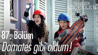 Domates gibi oldum! - Kırgın Çiçekler 87.  Resimi