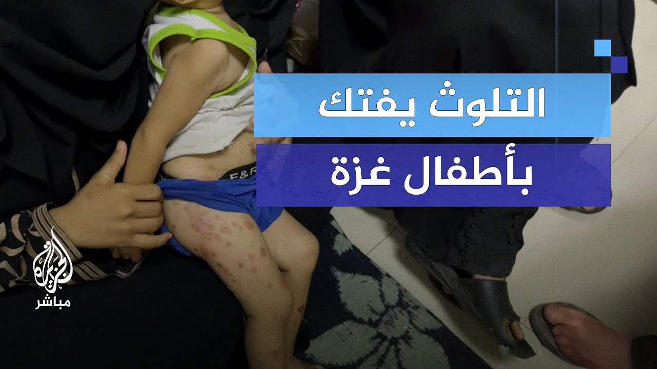 التلوث يتسبب بانتشار الطفح الجلدي والفيروسات بين الأطفال في غزة