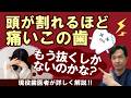 頭が割れるほど痛いこの歯、もう抜くかないのかな？ 現役歯医者が詳しく解説！！