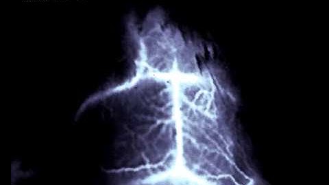 Non-Invasive Diagnostic Imaging of Stroke Using NIR-II Fluorescence