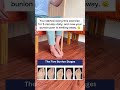 Bunion Pain Relief! 🔥🤯#bunions #exercise #painrelief