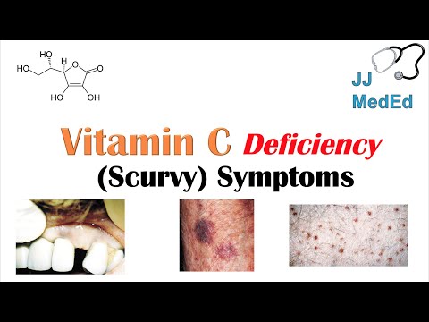 Vitamin C Deficiency (Scurvy) Symptoms (ex. bad teeth, fatigue), Why symptoms happen & who gets them