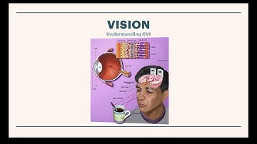 CViConnect – Identifiying CVI