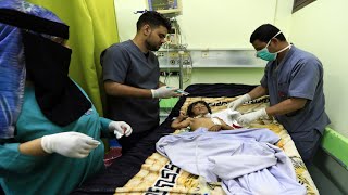 مركز الملك سلمان للإغاثة يواصل خدماته الصحية في اليمن