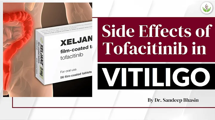 Potential Side Effects of Tofacitinib In Vitiligo ...