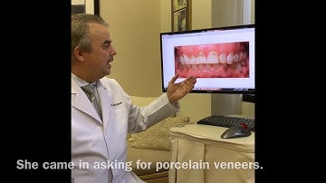No to Porcelain veneers, Yes to Bioclear,  a Porcelain Veneer Alternative to save you money an
