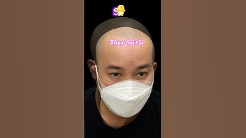 Thay đổi ngoạn mục sau xăm chân tóc SMP | Amazing Transformation after SMP Hair Tattoo