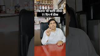 कतन भ फटट लवर 11 दन म ठक