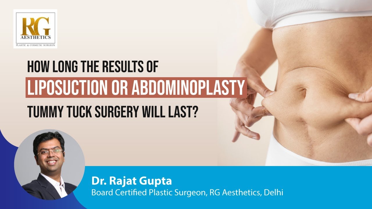 How long the result of Liposuction or Abdominoplasty Tummy Tuck Surgery  will last?