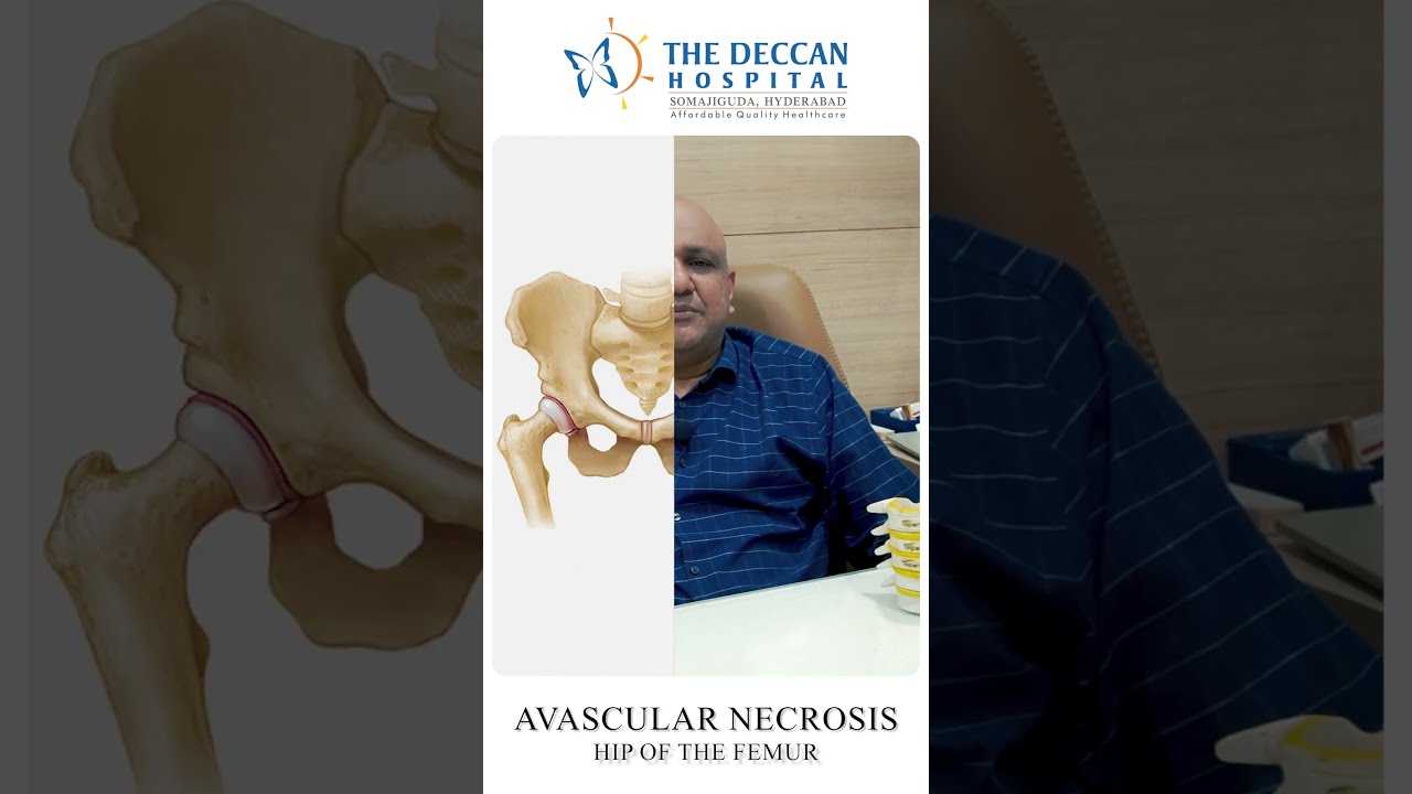 What Is Avascular Necrosis AVN Why Does It Happen How Do You Diagnose Deccanhospital