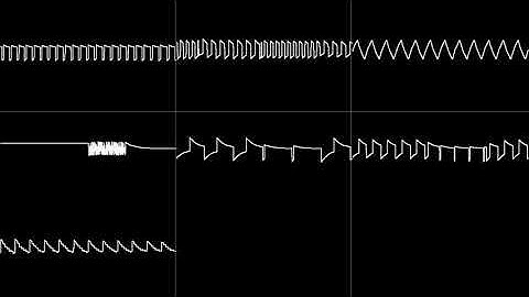 Bionic Commando Stage 1 VRC6 Remix