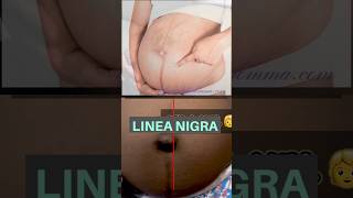 Linea Nigra 😱