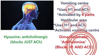 Antiemetics for motion sickness: antihistamines and anticholinergic medicines