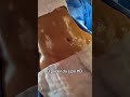 LIPOASPIRAÇÃO DE ALTA DEFINIÇÃO: Veja o resultado real dessa transformação! 💎
