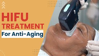 Live HIFU Treatment | Solution for Double Chin Reduction | Anti Aging Treatment in Delhi| SkinQure