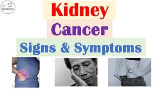 Kidney Cancer (Renal Cell Carcinoma) Signs and Symptoms (& Why They Occur)