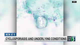 Cyclosporiasis and underlying conditions