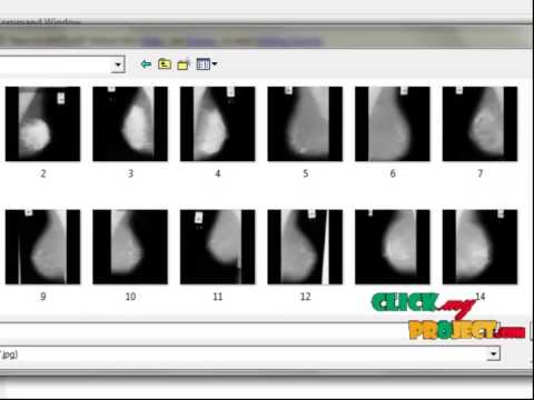 Local binary pattern online