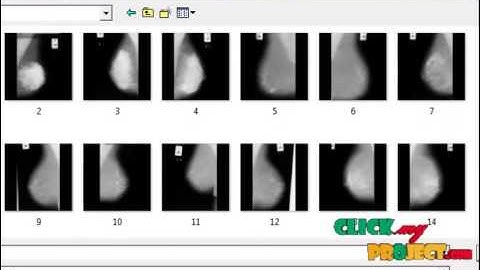 Final Year Projects | A Completed Modeling of Local Binary Pattern Operator for Texture Classi
