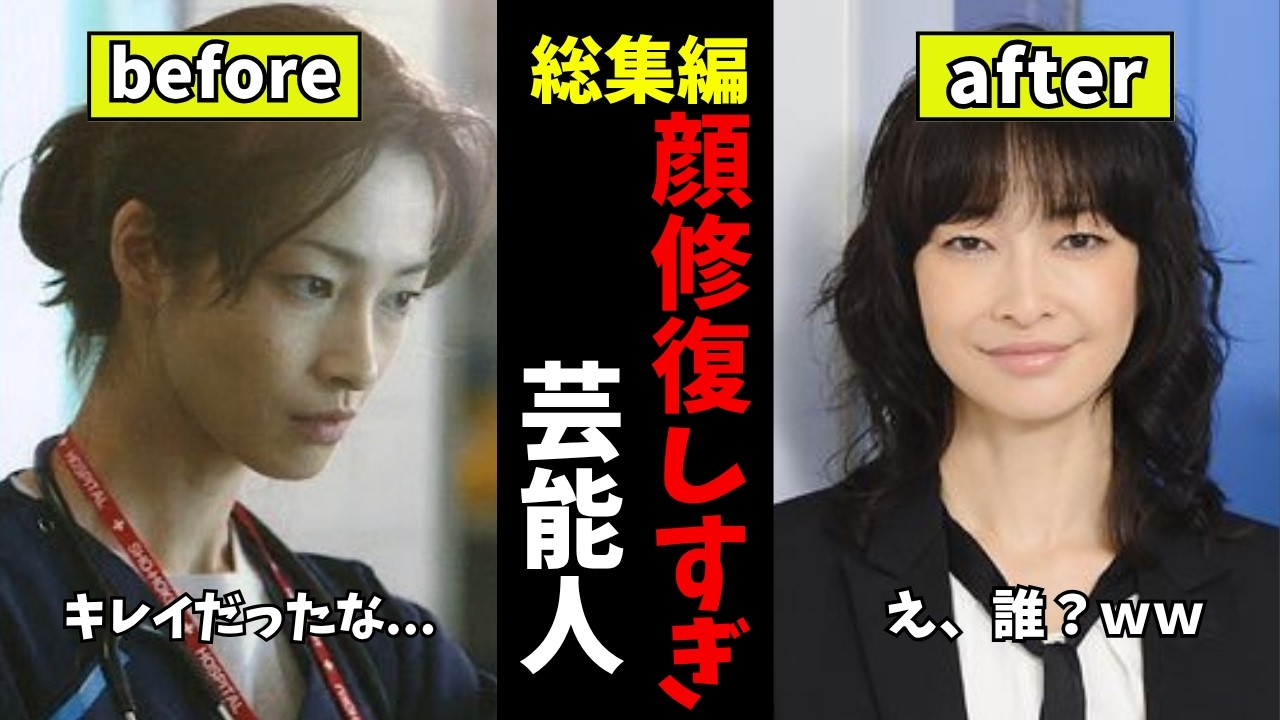 【ガルちゃん芸能】なんかおかしい...顔の変化がヤバすぎる芸能人　総集編【有益2ch】