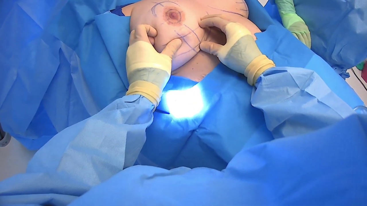DAVinci Plastic Surgery medical assistants try to pop a silicone breast  implant 