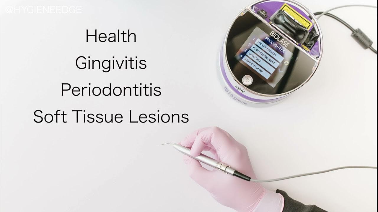 What The Dental Hygiene Laser Does with Biolase Epic Hygiene YouTube