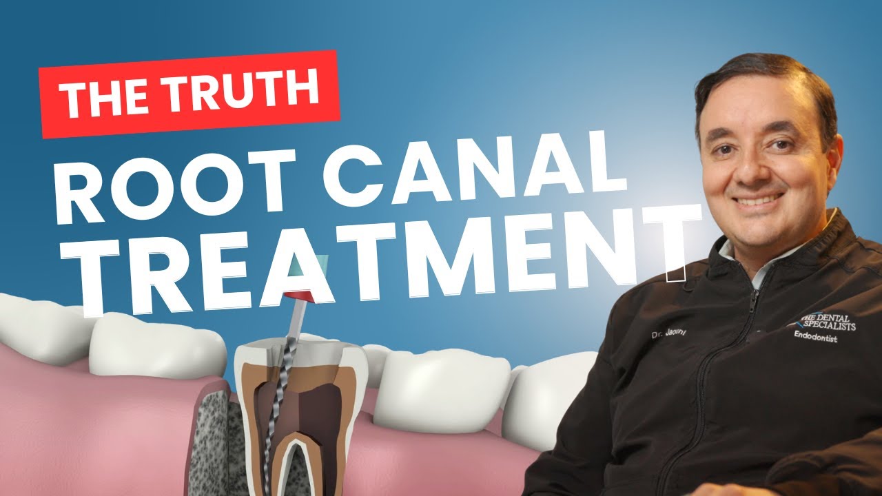 Are Root Canals Safe? Debunking the Biggest Myths About Root Canal Treatment