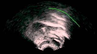 Ealveolar ejective half speed