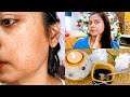 Only In 3 Days This DIY Face Pack Helped To Get My Skin Back || Skin Brightening Face Pack