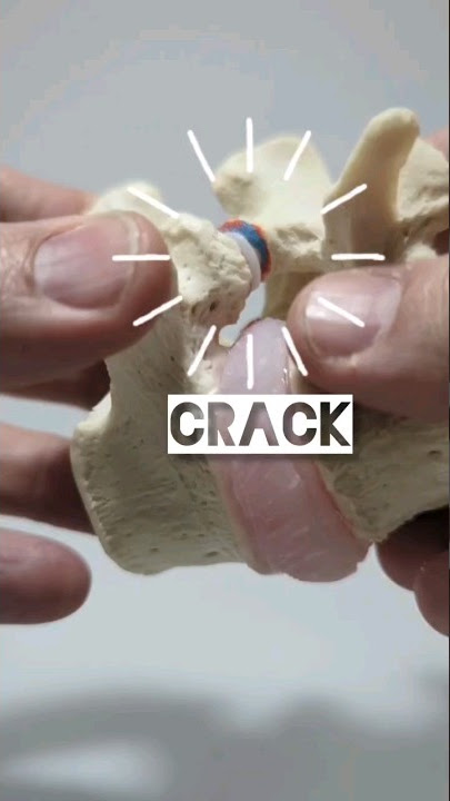 Sound Source of Cracking Joint _ Do you wonder where the sound is coming from?