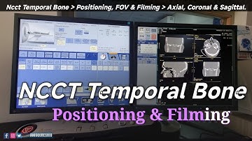 HRCT Temporal Bone | Positioning &  Filming | By Anis Qureshi