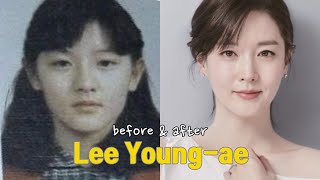 Lee Young-ae before and after