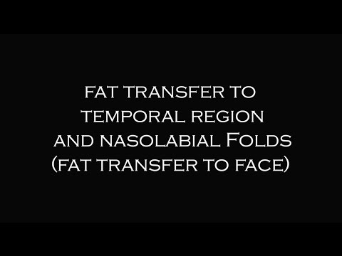 Fat Transfer to Face |  Plastic Surgeon Dr. Katzen Beverly Hills | Los Angeles | Las Vegas