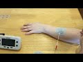 NMES and FES demonstration; also use of a movable electrode to find motor points