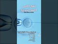 طريقى توضح عملية حقن اطفال الأنابيب