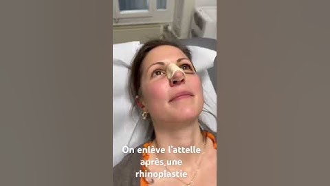 Retirer l’attelle après rhinoplastie @DrHerveRaspaldo #rhinoplastie #chirurgieesthetique