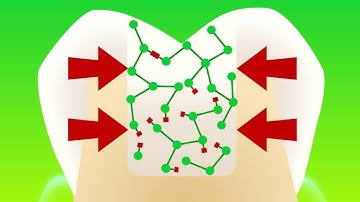 Filtek Bulk Fill Posterior Restorative- Fast & Easy