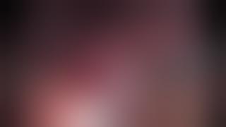 LAPAROSCOPIC EXCISION OF LARGE RT SIDED SUPRARENAL GLAND