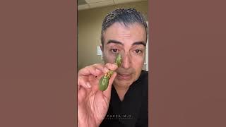 How to Reduce Malar Edema | Dr. Kami Parsa