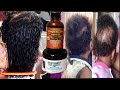 How oil help my kids hair to grow super fast with before and after picture and video